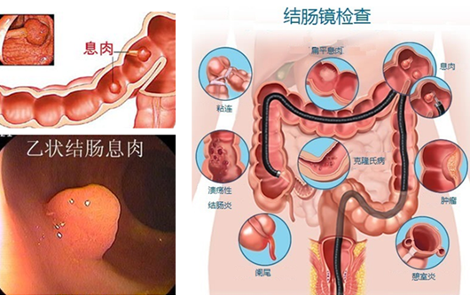 萎縮性胃炎真的“很嚇人”？看完這“七個事實”你就明白了